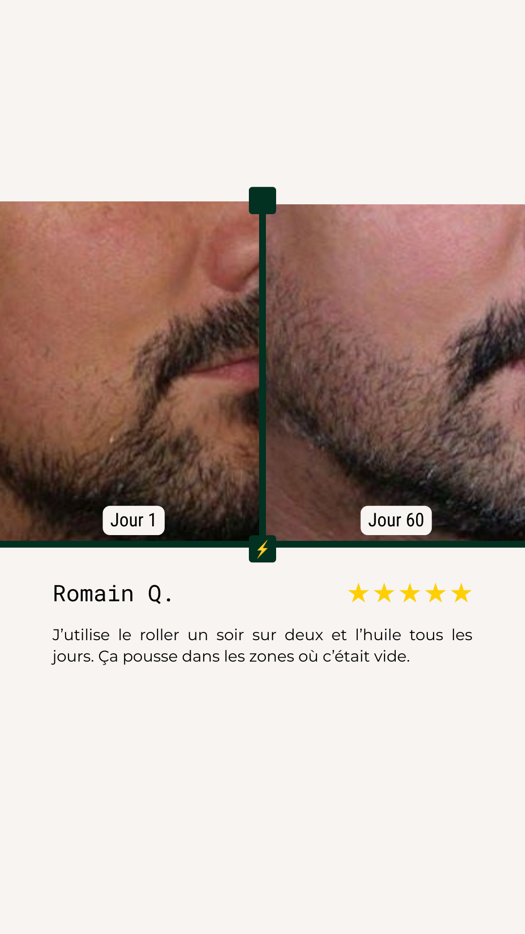 <p>Avant/Après</p>