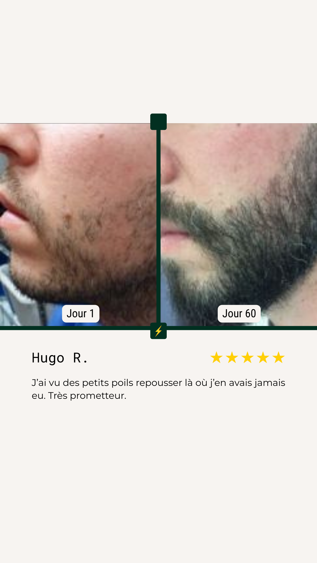 <p>Avant/Après</p>