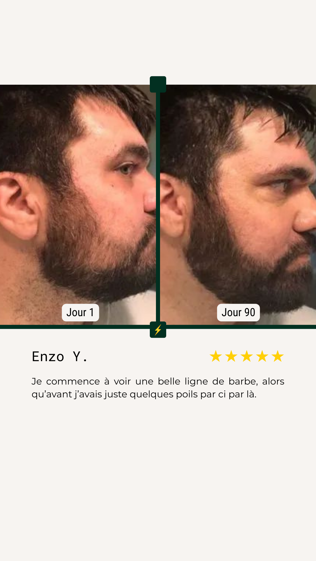 <p>Avant/Après</p>