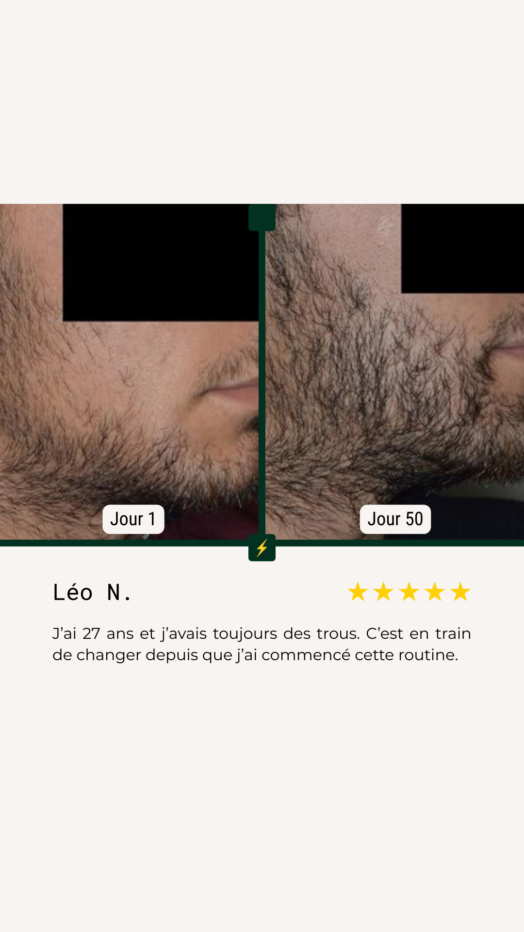 <p>Avant/Après</p>