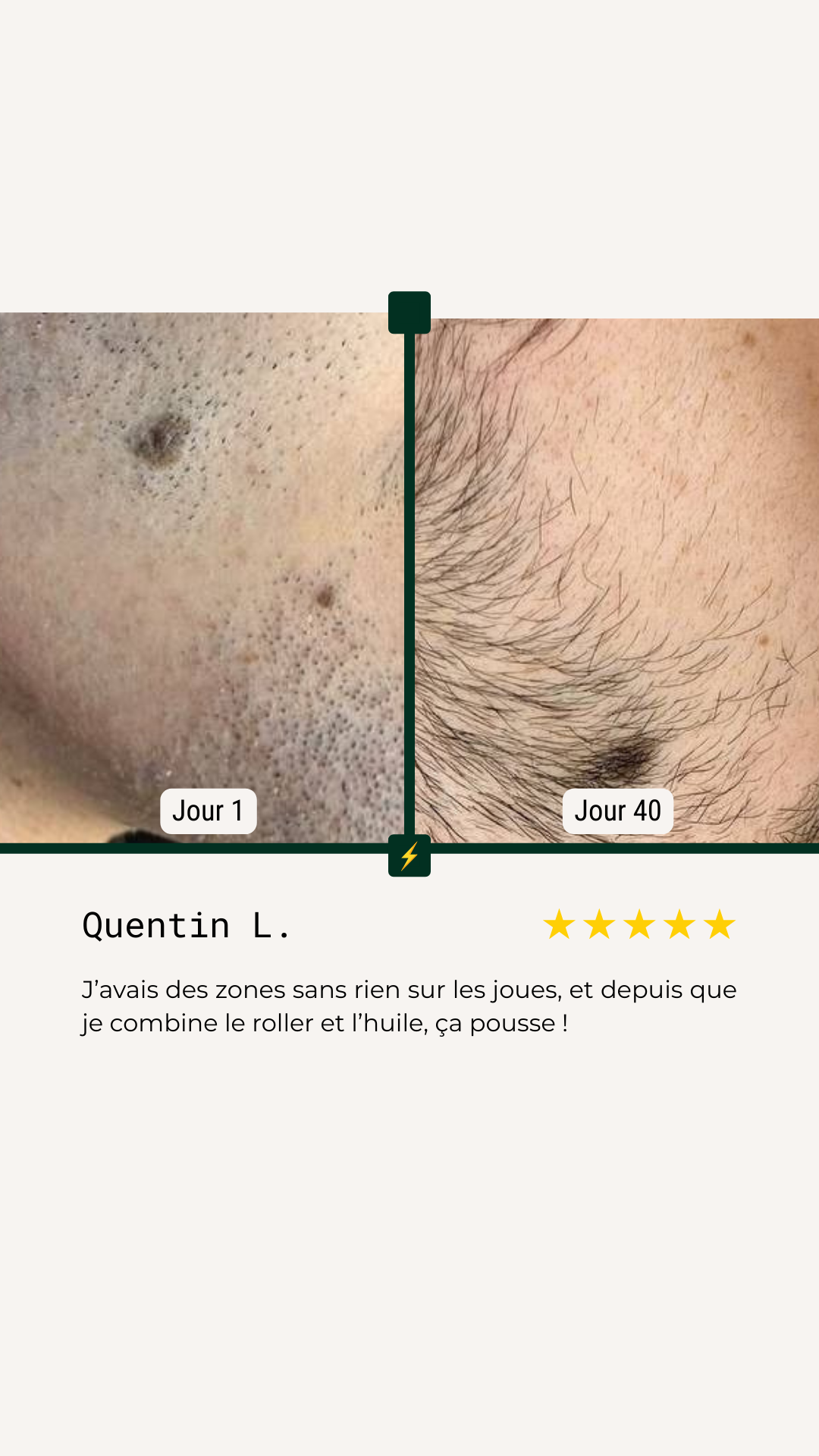 <p>Avant/Après</p>