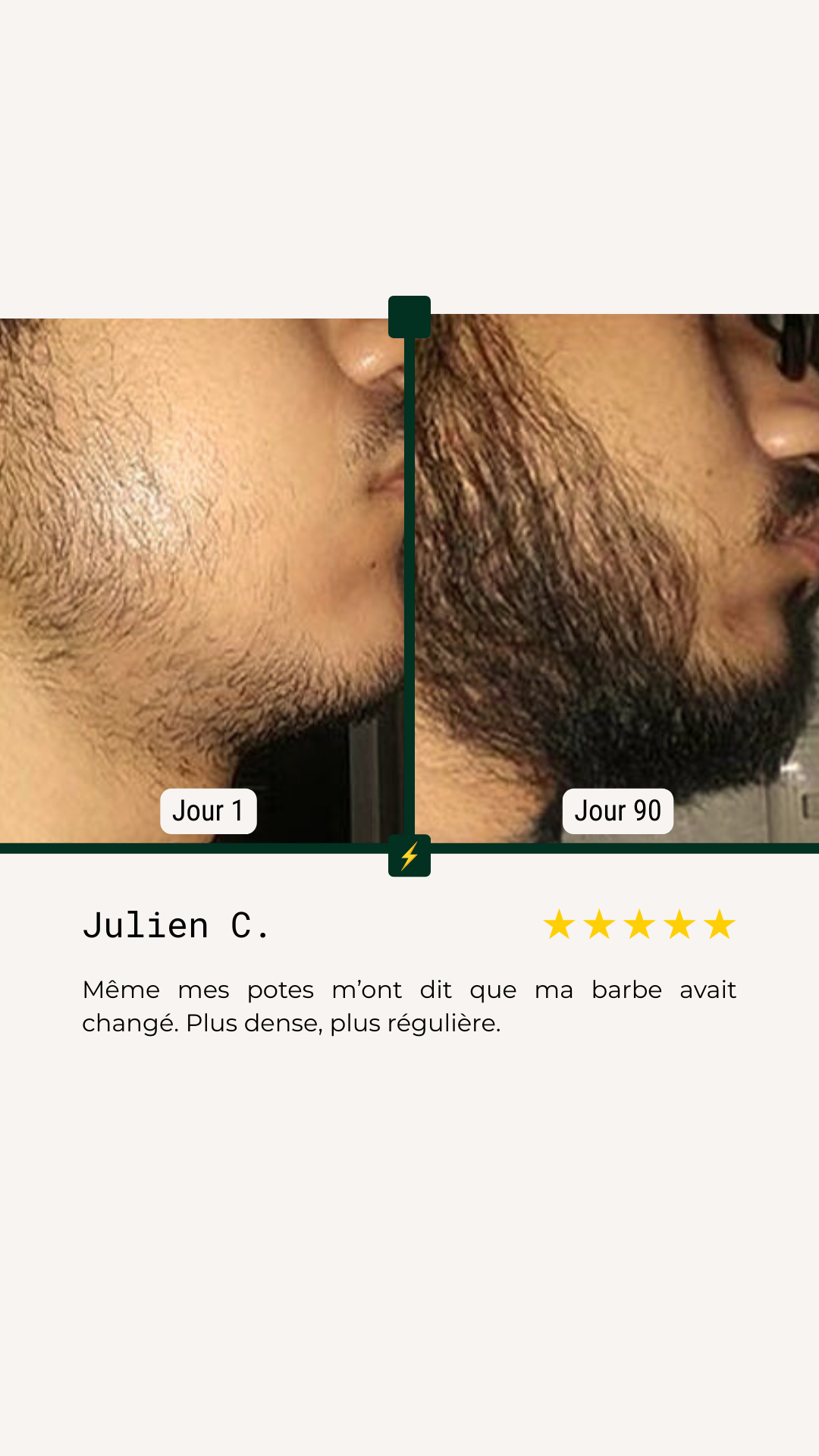 <p>Avant/Après</p>